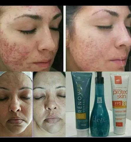Kit gomage e Lan creme