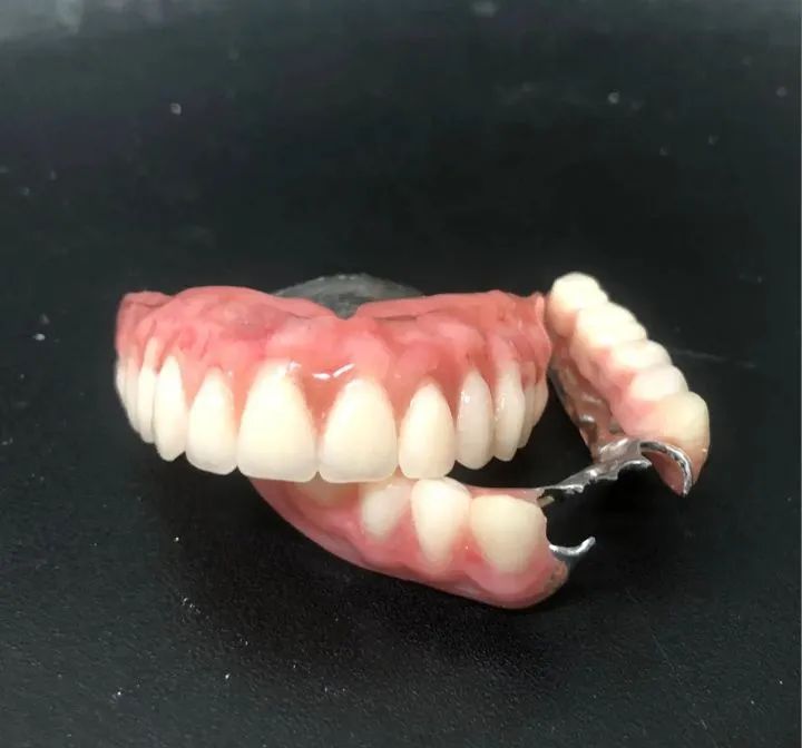 Prótese Dentária a partir de 200 reais  - Foto 5