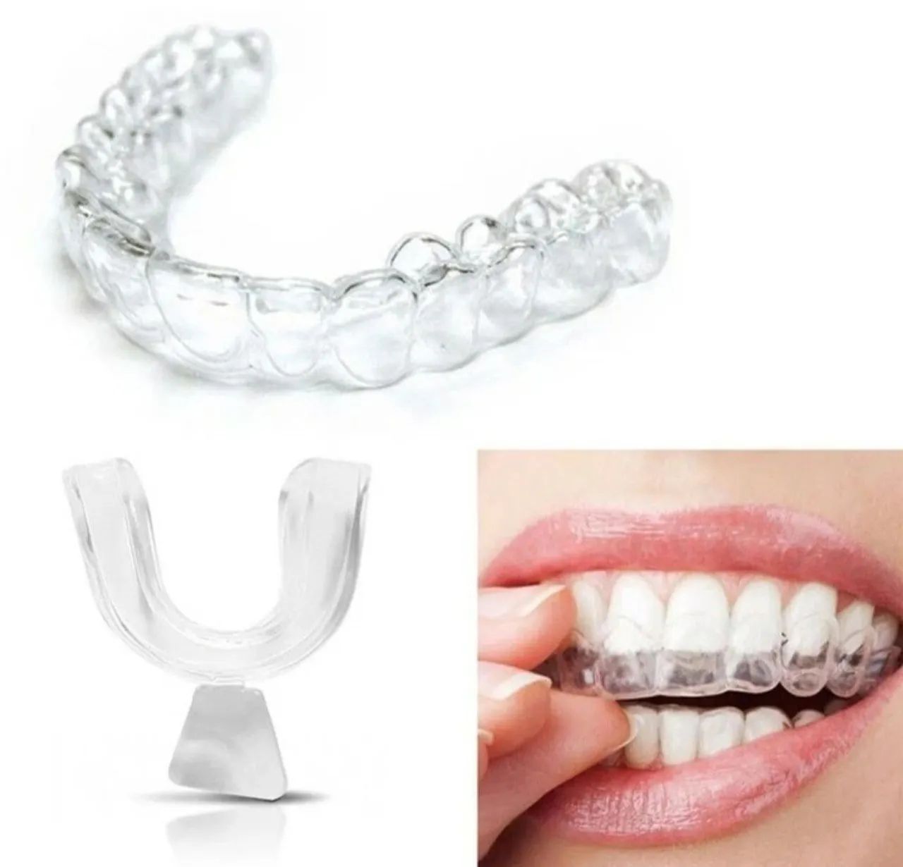 Moldeira para tratar bruxismo e ronco e clarear dentes