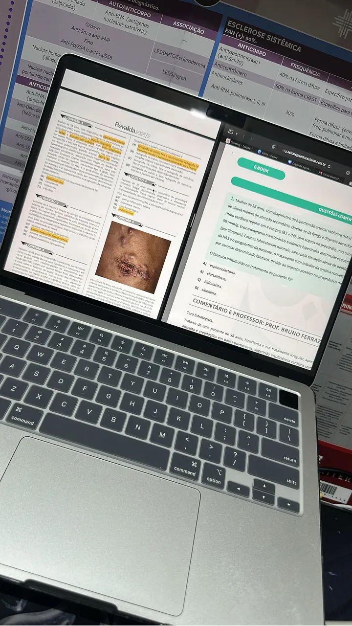 MacBook M4  - Foto 5