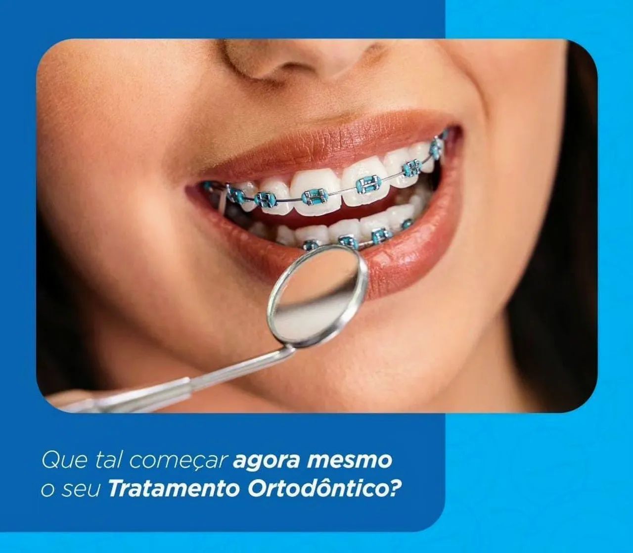 RESTAM APENAS 7 VAGAS 