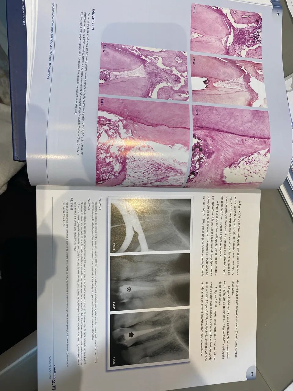 Livro endodontia conceitos biológicos e recursos tecnológicos  - Foto 2