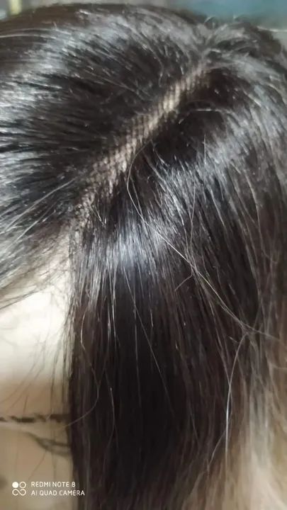 Lace orgânica fibra Premium loira com franja - Foto 5