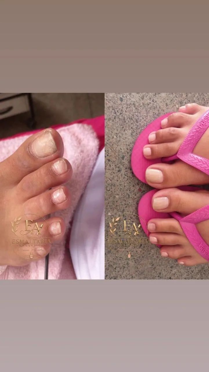 ? MANICURE E PEDICURE A DOMICÍLIO ? - Foto 4