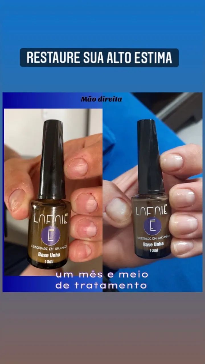 Base Fortalecedora de Unha  - Foto 2