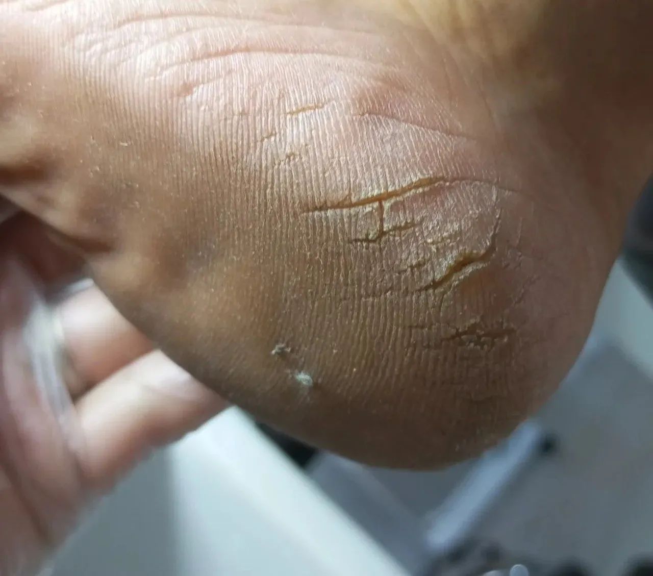 Manicure e Pedicure a domicílio  - Foto 4