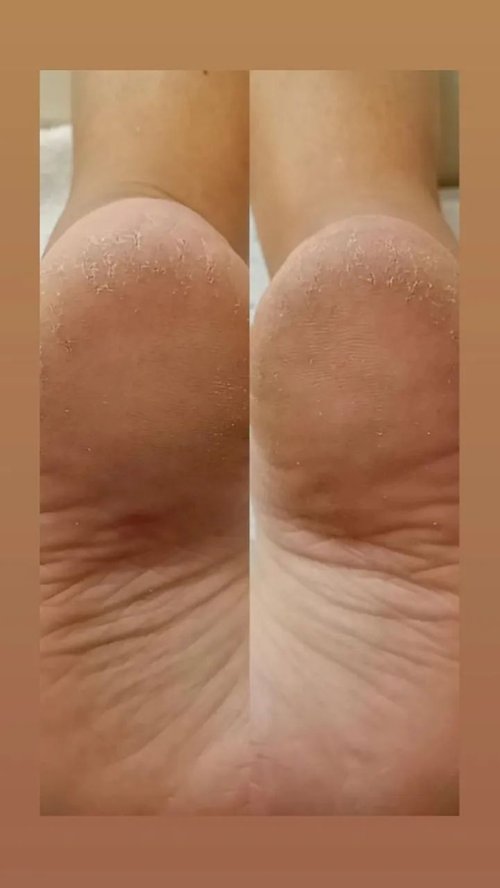 Modelo várias áreas 