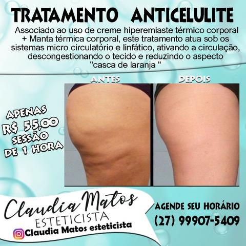 Tratamento anti celulite