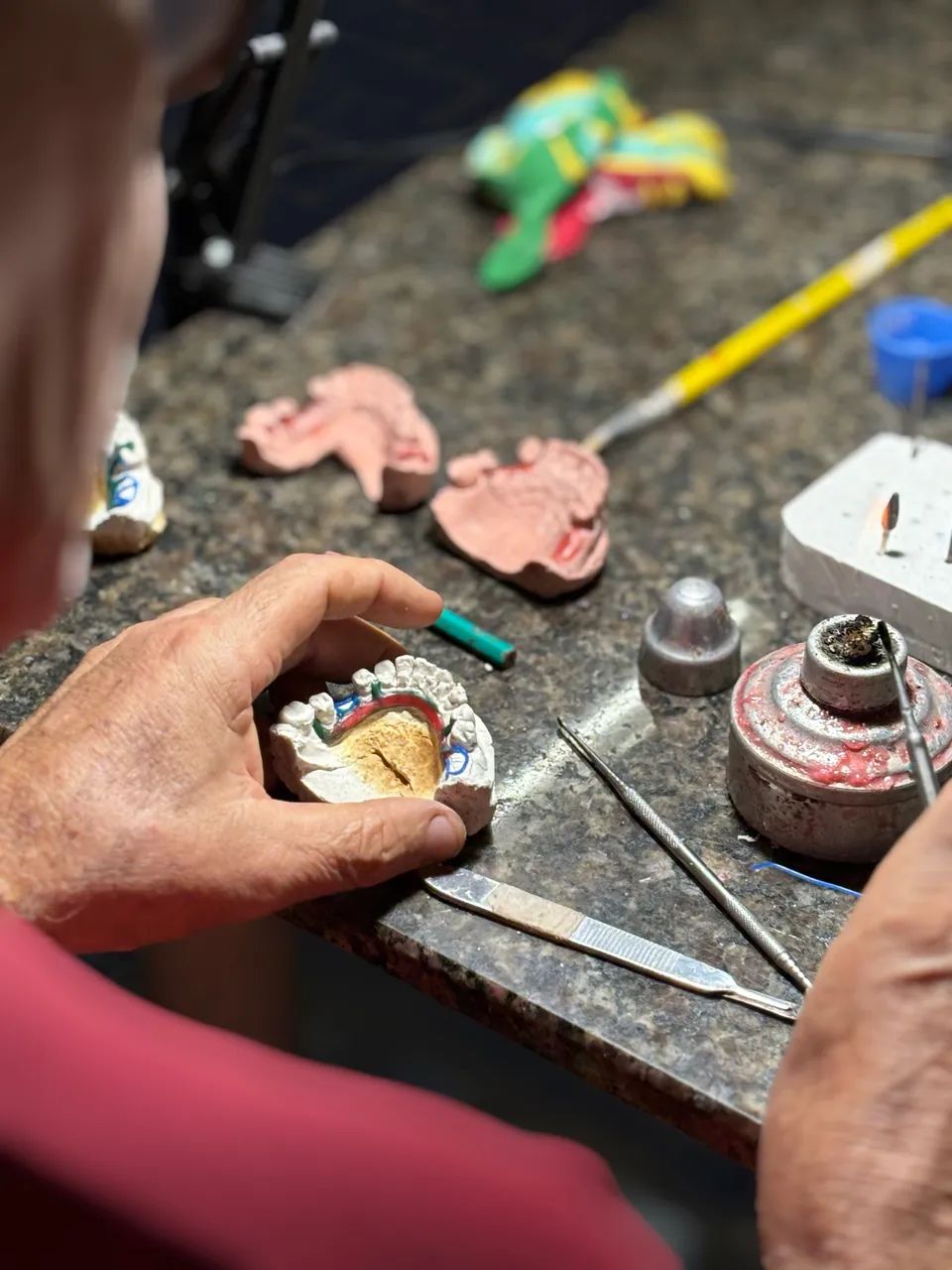 Laboratório de Prótese Dentária - Qualidade, Agilidade e Ótimo Preço! - Foto 4