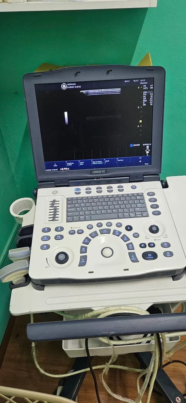 Aparelho de ultrassom 