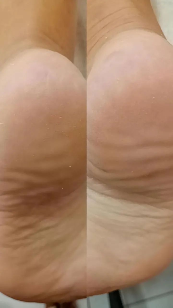 Modelo várias áreas  - Foto 2