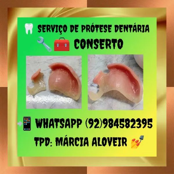 PRÓTESE DENTÁRIA ( DENTADURAS) - Foto 2