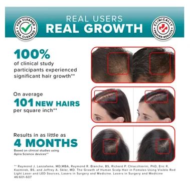 Capacete de terapia para crescimento do cabelo - Foto 3