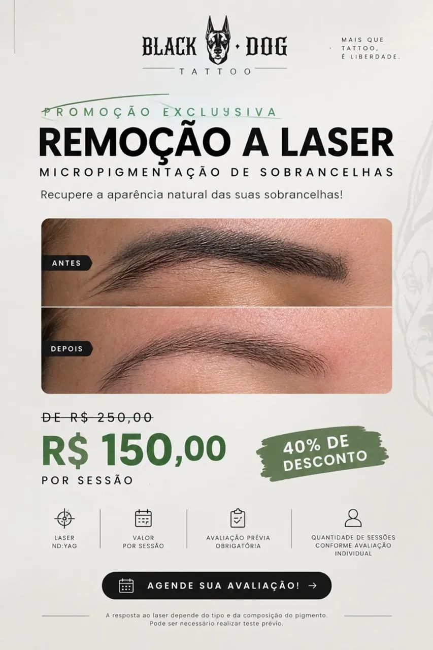 Remoção de pigmentação de sobrancelhas  - Foto 2