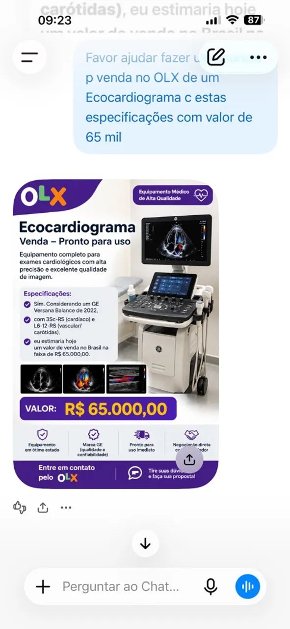 ECOCARDIOGRAMA 