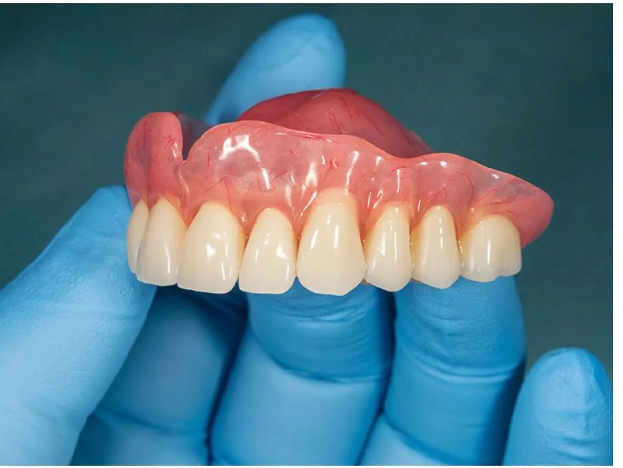 Dentadura direto com protético  - Foto 5