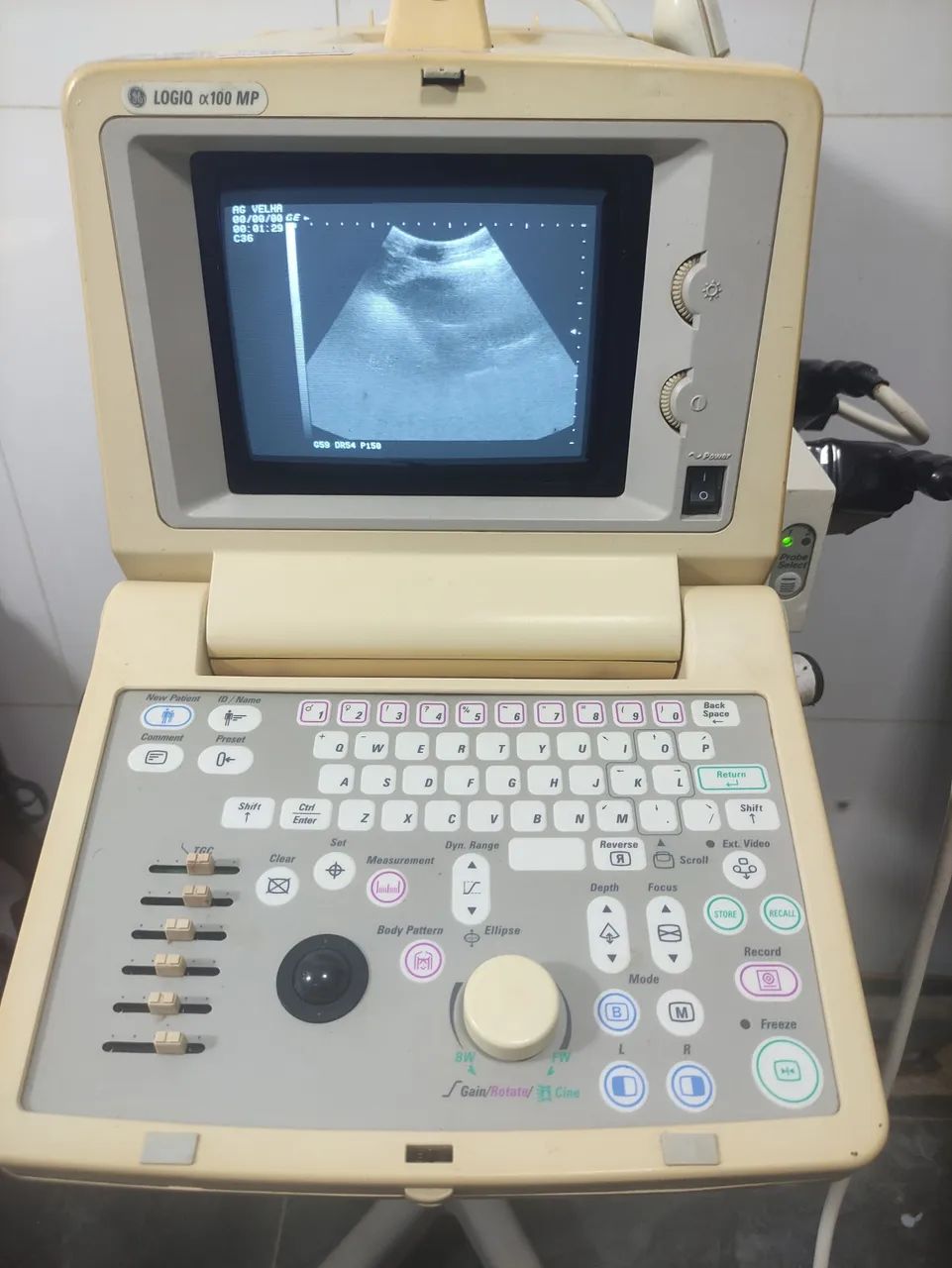 Ultrassom GE Logiq 100 MP