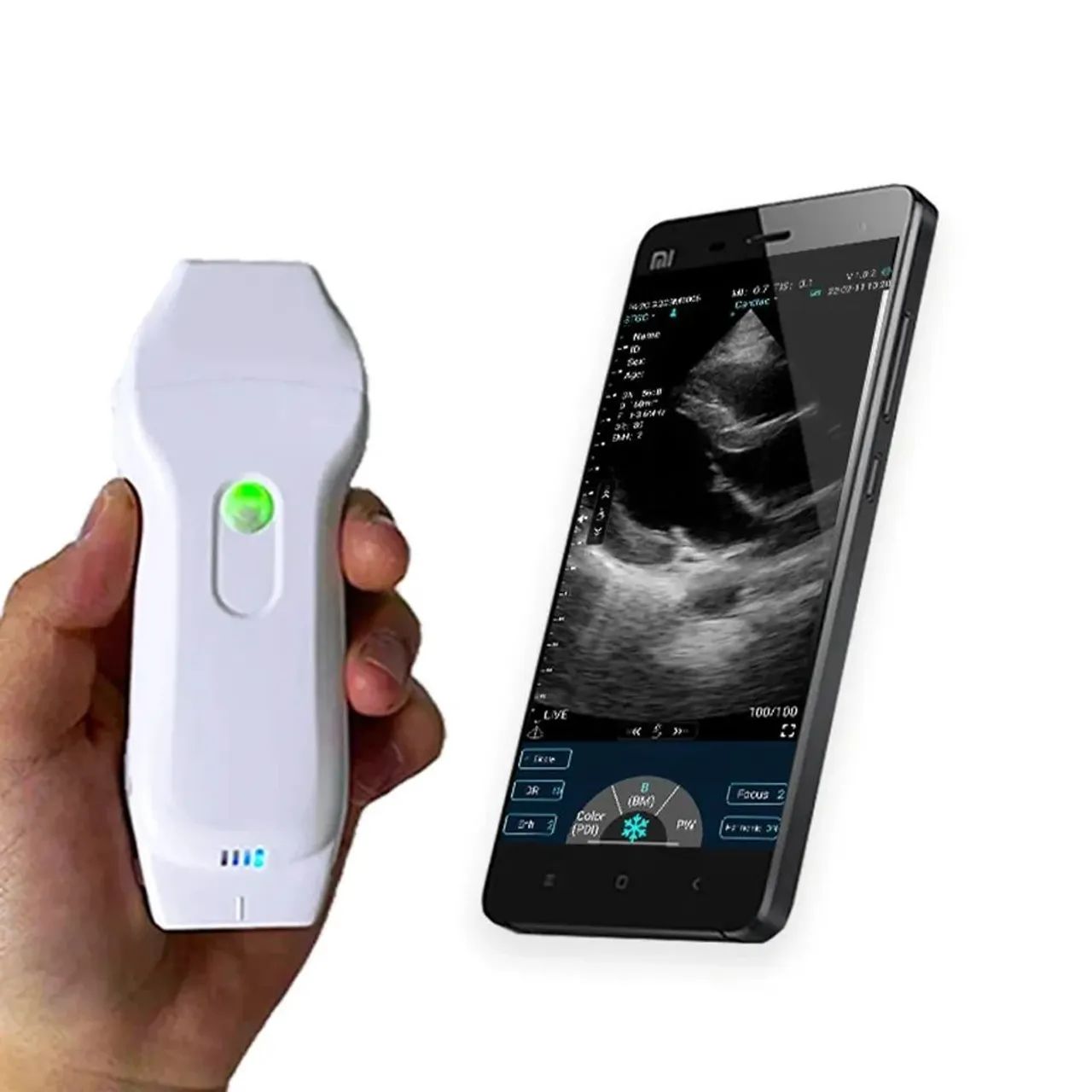 Sonda Ultrassom Scanner portátil 3 em 1 Pró  - Foto 5