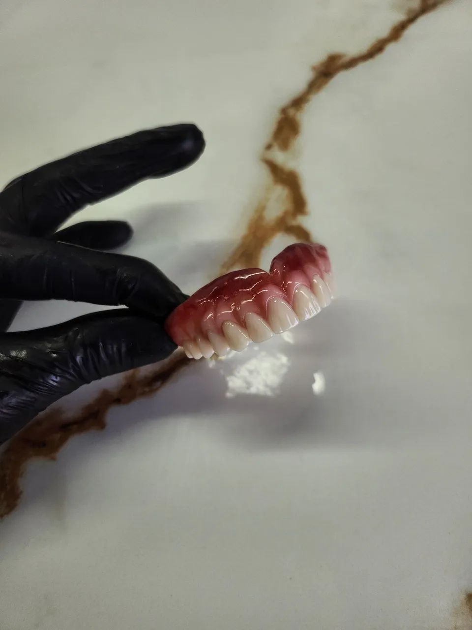 Concertos de dentaduras em menos de 24 horas ! - Foto 3