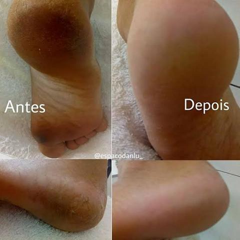 Spa dos pés - Atendimento a domicílio
