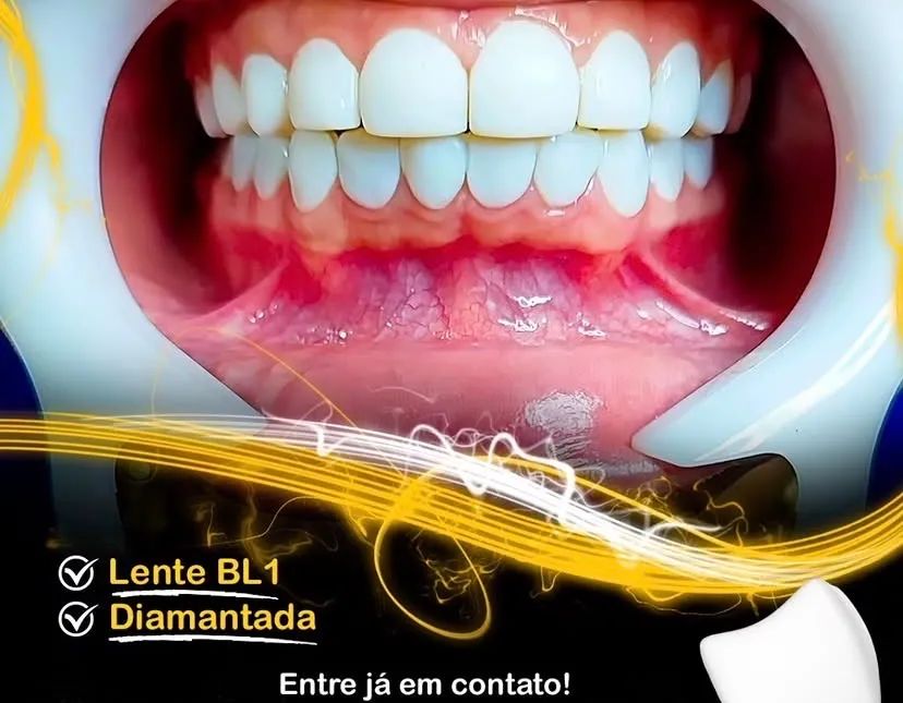LENTE DE RESINA 