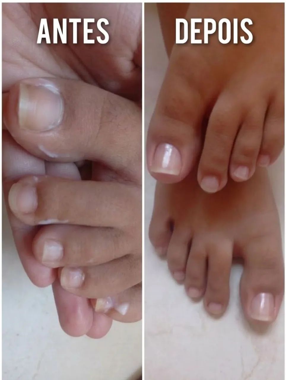 Unhas a domicílio  - Foto 3