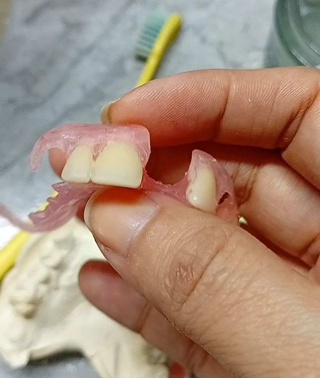 PRÓTESE DENTÁRIA ( DENTADURAS) - Foto 4