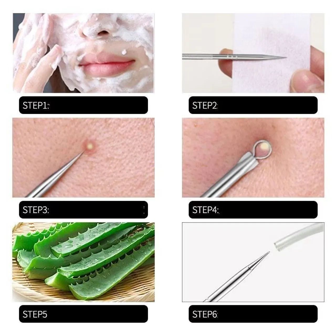 Kit de ferramentas tirar cravos acnes e espinhas em aço inoxidável - Foto 2