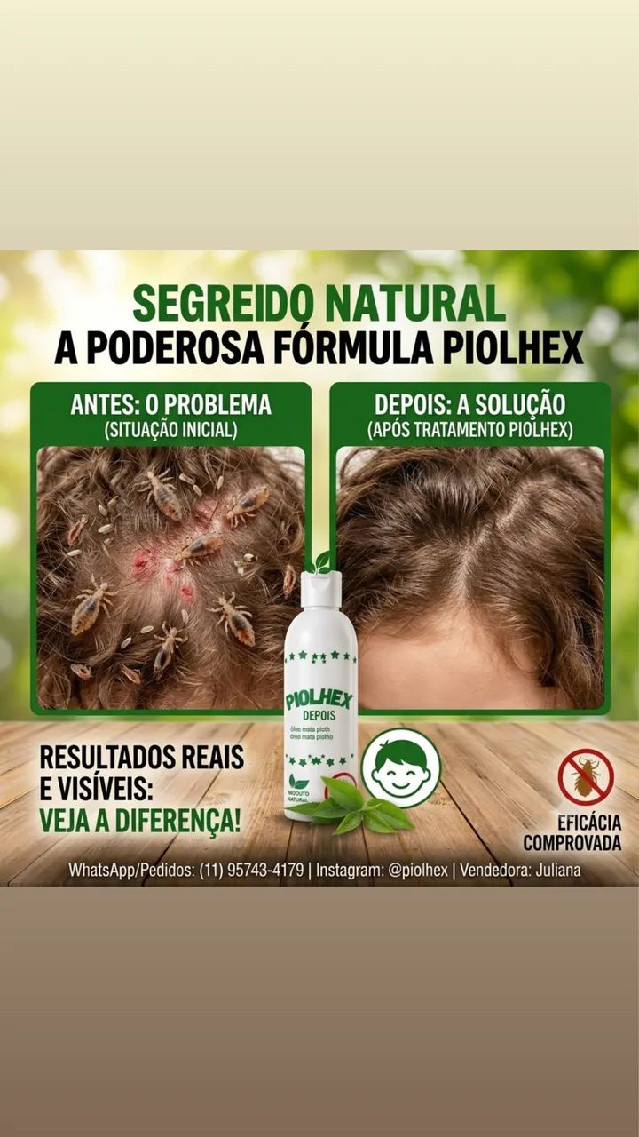 Piolhex mata piolhos  - Foto 3
