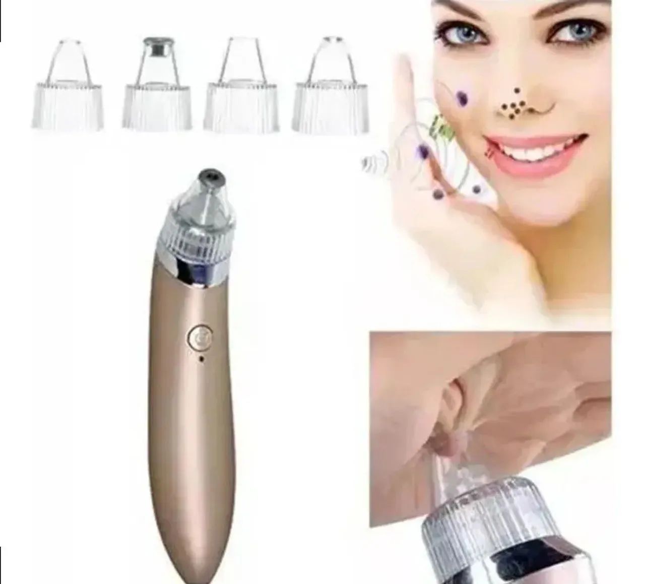 Removedor de acnes noco