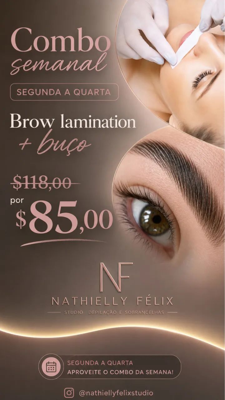 Depilação  SOMENTE FEMININA  - Foto 5