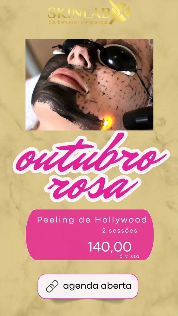 Remoção de tatuagem 