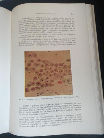 Citologia do trato genital feminino - Foto 2