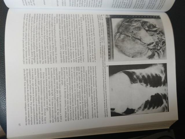 Livro Parasitologia Humana - Foto 2