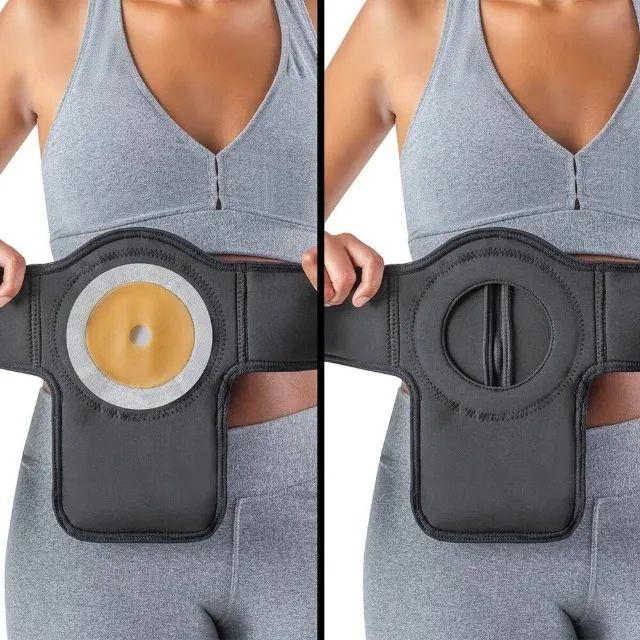Suporte para Bolsa de Colostomia Ostolight - Hidrolight - Foto 5