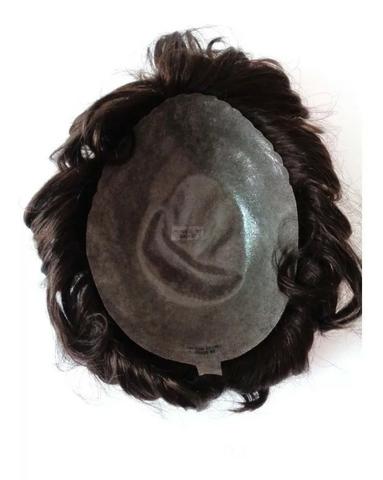 Preço promocional de prótese capilar com vouche de colocação em profissional top de linha - Foto 4