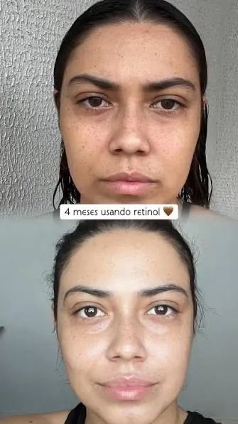 O segredo das coreanas - Foto 2