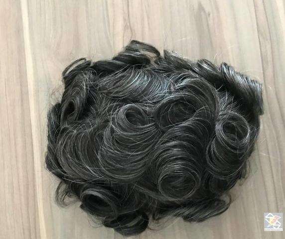 Preço promocional de prótese capilar com vouche de colocação em profissional top de linha - Foto 3