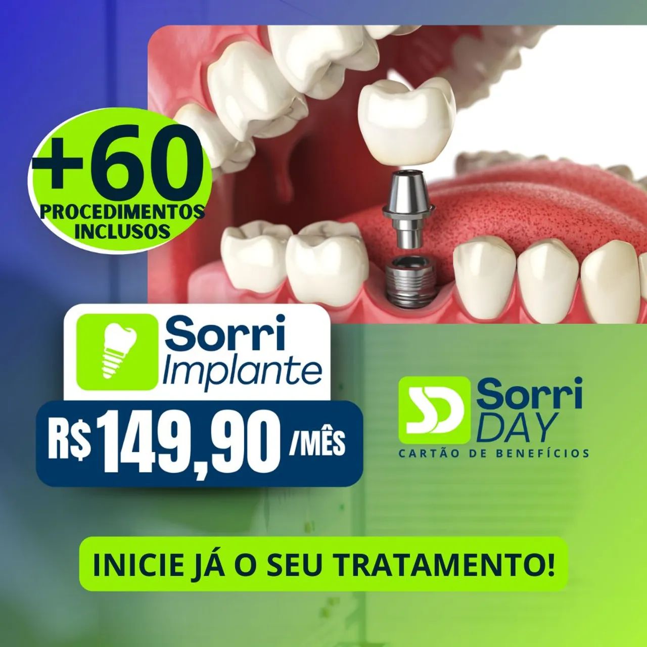 Implantes dentários  - Foto 3