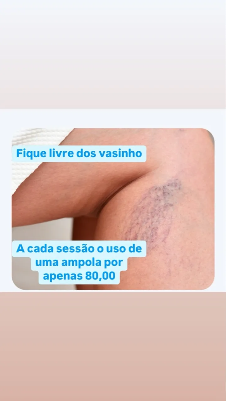 Fique livre dos vasinhos 