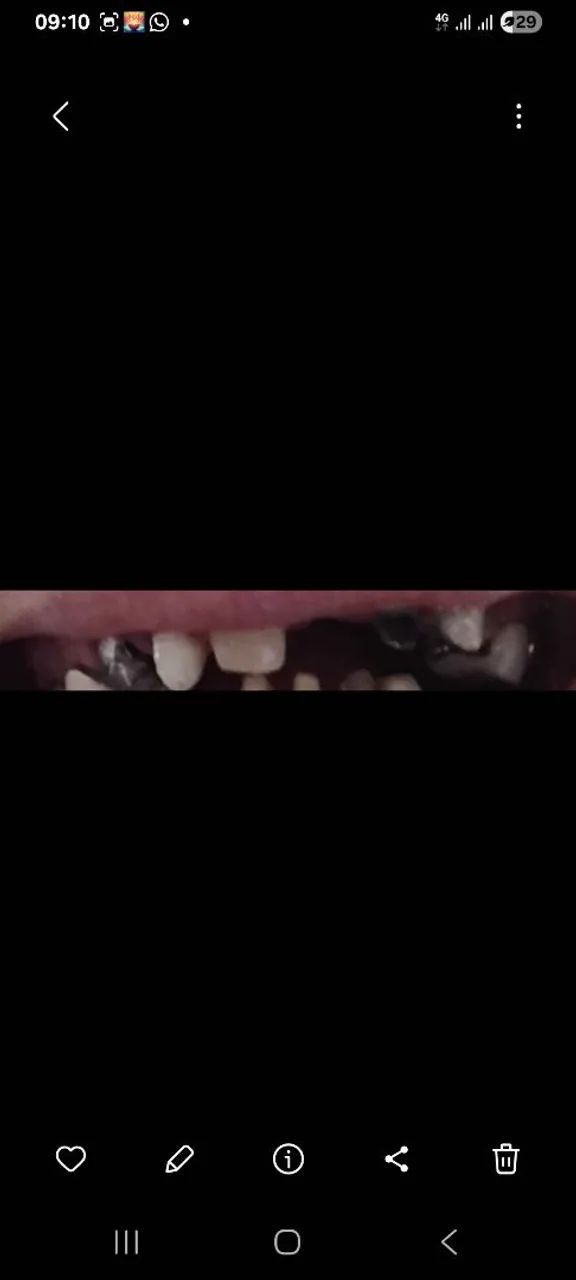 Dentista próximo da Estação de Metrô Eng Rubens Paiva  - Foto 2