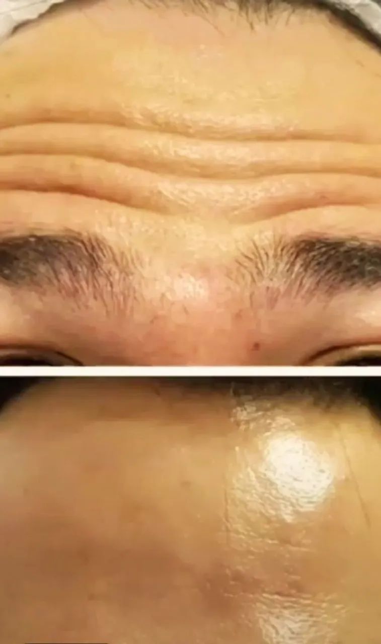 Limpeza de Pele 35+ - Foto 4