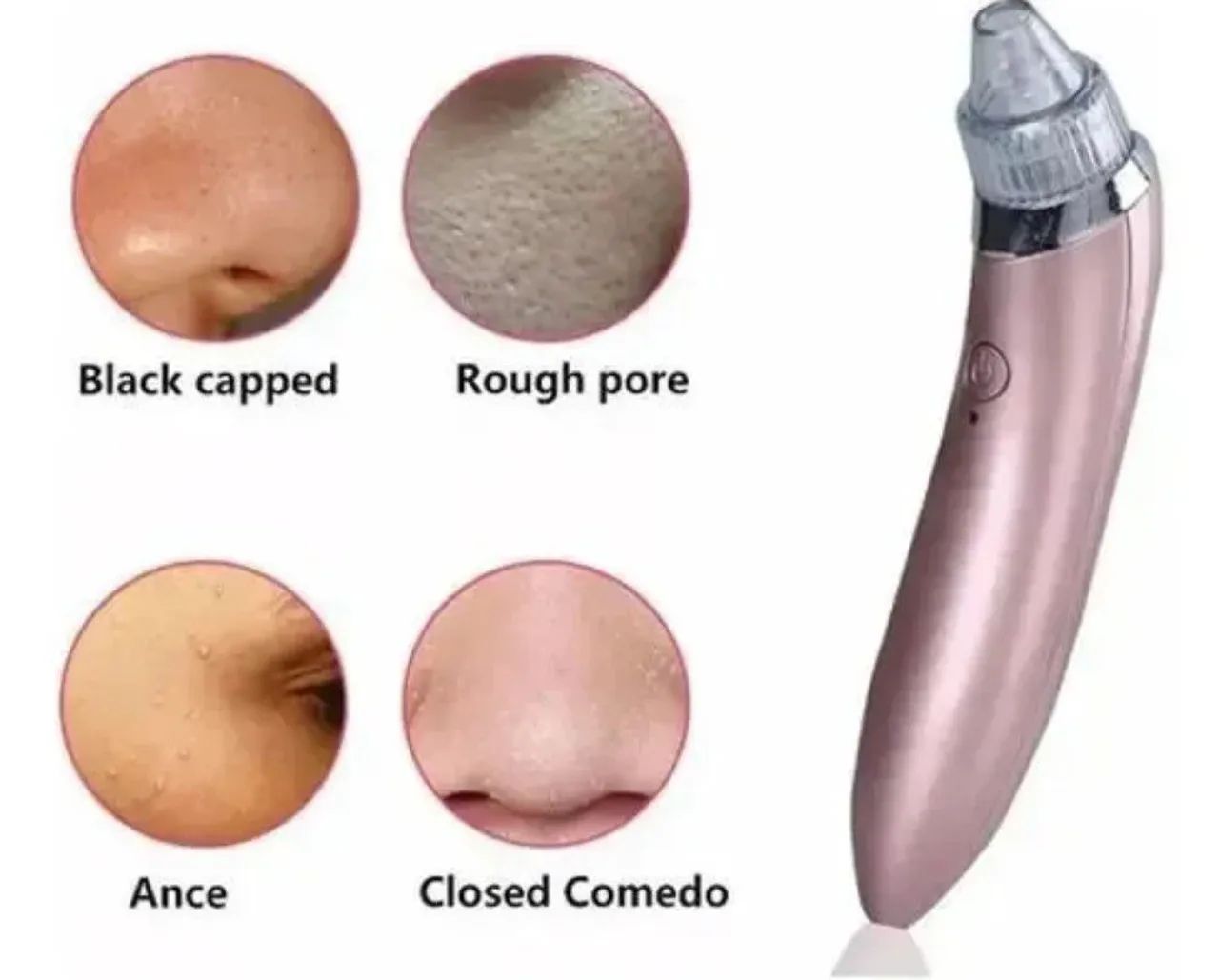 Removedor de acnes noco - Foto 2