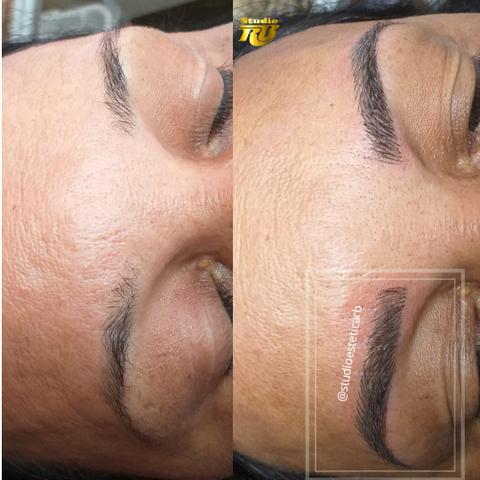 PROMOÇÃO temporária fim de ano Micropigmentação Microblanding - Foto 4