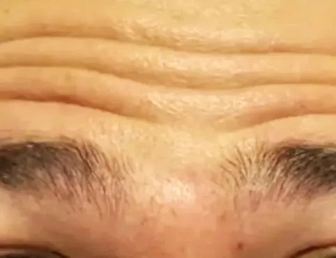 Limpeza de Pele 35+ - Foto 5