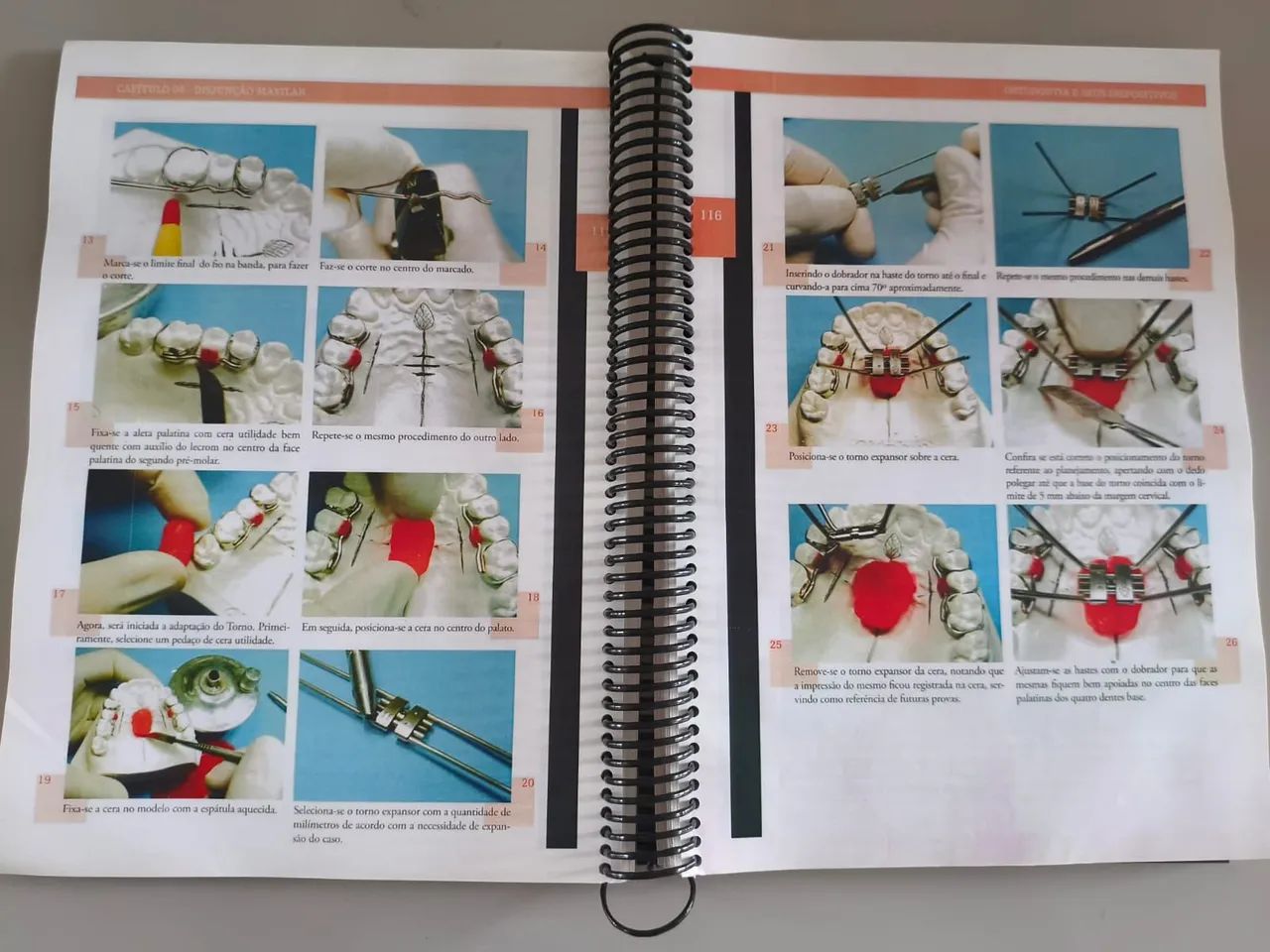 Livro ortodontia e seus dispositivos  - Foto 3