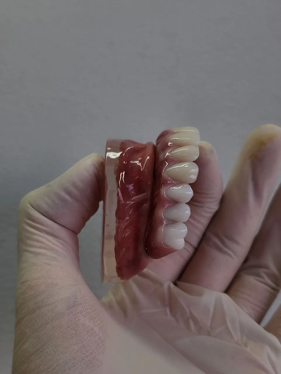 Confecção de dentaduras! - Foto 4