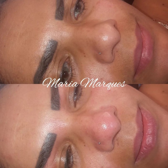 Limpeza de pele profunda + Dermaplaning