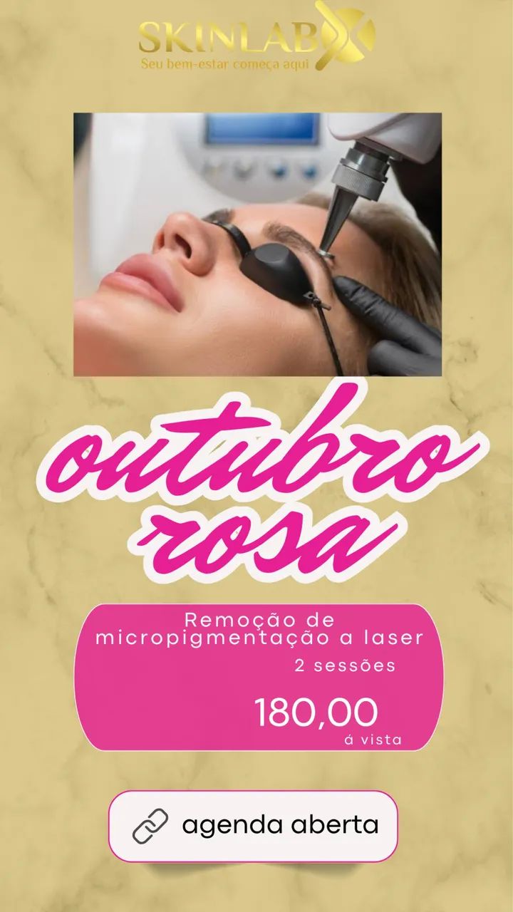 Remoção de tatuagem  - Foto 2