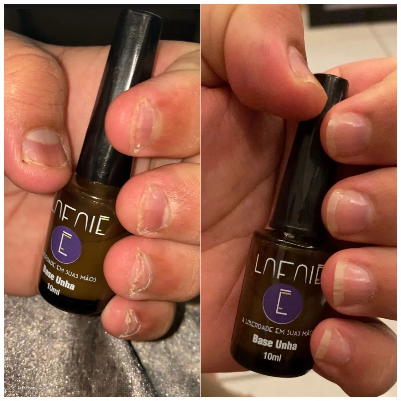 Base Fortalecedora de Unha  - Foto 5